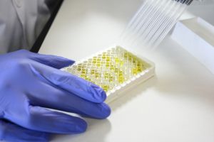 El CSIC firma una licencia para facilitar que sus test de anticuerpos de covid-19 lleguen a los países más necesitados
