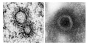 Vesículas con moléculas del genoma del virus de la gripe