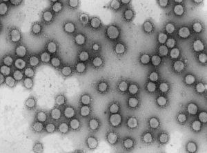 Imagen de microscopía electrónica de un coronavirus