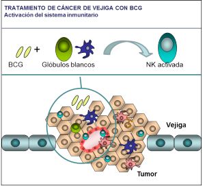 Esquema del proceso de activación del sistema inmunitario con BCG.