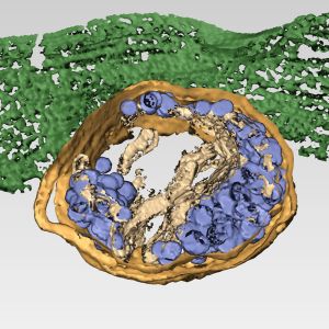 Tomografía electrónica tridimensional de una célula infectada por el reovirus humano. Los virus maduros infectivos (azul oscuro) son transportados por lisosomas modificados (amarillo) hasta la membrana plasmática (verde). Las mitocondrias (rojo) rodean las estructuras virales.