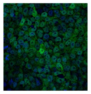 Imagen de células madre embrionarias con bajos niveles de PI3K