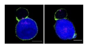 Los linfocitos de ratones control (a la izquierda) forman una sinapsis con células presentadora de antígeno (en azul). El centro organizador de microtúbulos (en rosa) se orienta hacia la zona de contacto entre las dos células que activan la actina (en verde). Los linfocitos deficientes en una copia de SNX27 (a la derecha) no organizan la sinapsis de forma correcta. 