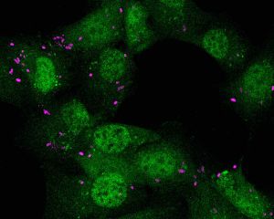 Cultivo de fibroblastos expresando un regulador de respuesta inflamatoria (en verde) infectados con Salmonella (en magenta)/