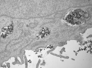 Nanopartículas de óxido de hierro en el interior de vesículas celulares en una imagen tomada con un microscopio electrónico de transmisión (TEM). 