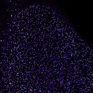 New method for detection of fluorescent proteins in cells