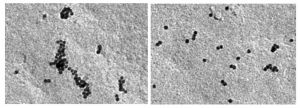 Imágenes de microscopía electrónica de la formación de nanooligómeros del receptor de las células T (TCR) en células que expresan CCR5 (izquierda), frente a la formación en células deficientes en CCR5 (derecha). 