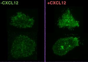 Imágenes de microscopía de reflexión interna total. Células expresando CXCR4 (spots verdes) en ausencia (izquierda) o en presencia del ligando (derecha). Se resalta la formación de agregados tras activar las células con CXCL12 en situación basal.