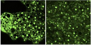 Imagen en la que se observan diferencias en el desarrollo de los adipocitos (fluorescencia verde) en tejido adiposo procedente de un ratón sano o con mutaciones en la proteína Dido.