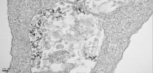 Imagen de microscopía de transmisión electrónica de células infectadas con SARS-CoV2 y tratadas con nanopartículas de óxido de hierro