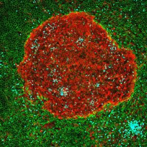 Imagen de un agregado multicelular en la cavidad peritoneal tras 4 horas de infección con E. coli (macrófagos en rojo, neutrófilos en azul y células mesoteliales en verde). 