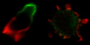 Líneas celualres de leucocitos que expresan el receptor CXCR4 (izquierda) o mutantes (derecha) donde se aprecia qeu estas últimas no forman un frnete de avance definido (en verde)