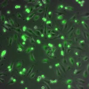 Esta imagen muestra células Hela donde las mitocondrias se han teñido en verde. Esta imagen se obtuvo tras 12 h de exposición al agente quimioterapéutico TRIAL. Las células muertas (mas redondeadas) muestran una mayor cantidad de mitocondrias que las células vivas