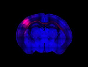 Sección horizontal del cerebro del ratón. Un grupo de neuronas de la corteza iluminadas en rojo extienden sus axones a través del cuerpo calloso para conectar con el hemisferio contralateral. 