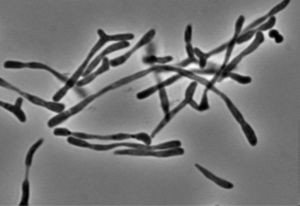 Salmonella enterica deficiente en PBP2 y PBP3SAL creciendo en medio ácido con escasos nutrientes