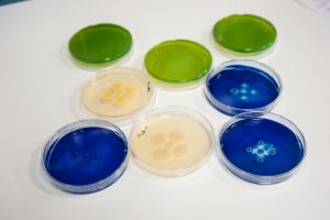 Placas de Petri con cepas de superbacterias
