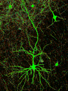 Neurona teñida en verde con GFP