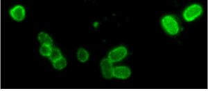 Imagen obtenida por microscopía de fluorescencia de Salmonella enterica utilizando el sistema de morfogénesis que se activa en el ambiente intracelular. 