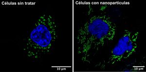 Imagen de una célula tumoral donde se aprecian los cambios en la morfología de las mitocondrias (en verde) tras el tratamiento con nanopartículas de óxido de hierro recubiertas con DMSA