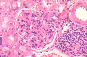 Image showing renal pathology in mice with lupus-like disease