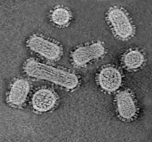 Sección de un tomograma del virus de la gripe