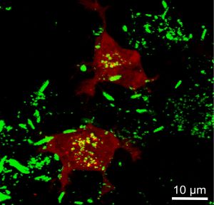 Prions (stained in green) promote the formation of intracellular amyloid aggregates in target cells