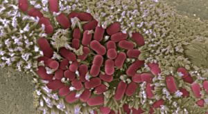 Imagen microscópica de la mucosa intestinal afectada por E.coli