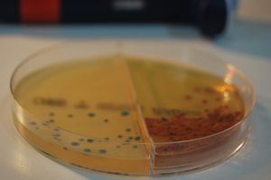 Placa de cultivo con diferentes cepas bacterianas