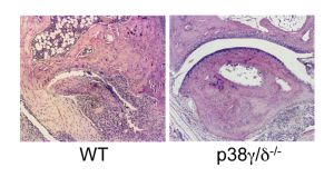 In an arthritis model, mice that lack p38γ/δ are protected against joint damage.