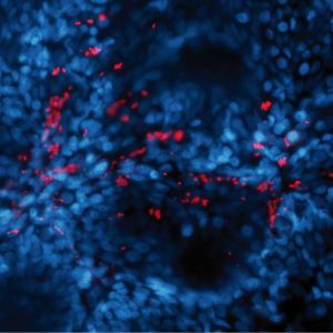 Bacterias EHEC (teñidas en rojo) unidas a las células de la mucosa del colon (el núcleo de las células está teñido en azúl) en una biopsia de tejido.