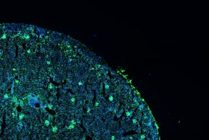 Imagen de un corte de un riñón de un ratón enfermo de lupus en el que se observa en verde la inflamación de los glomérulos renales
