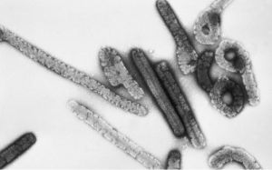 Micrografía electrónica de transmisión en la que se muestran viriones filamentosos del virus de Marburgo