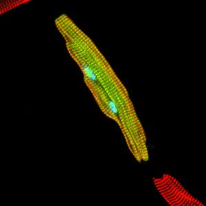 Cardiomiocito adulto derivado de células CMC que muestra tinción roja de la proteína actina alfa de músculo liso