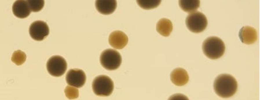 Descubren un mecanismo que acelera la evolución de bacterias resistentes a los antibióticos